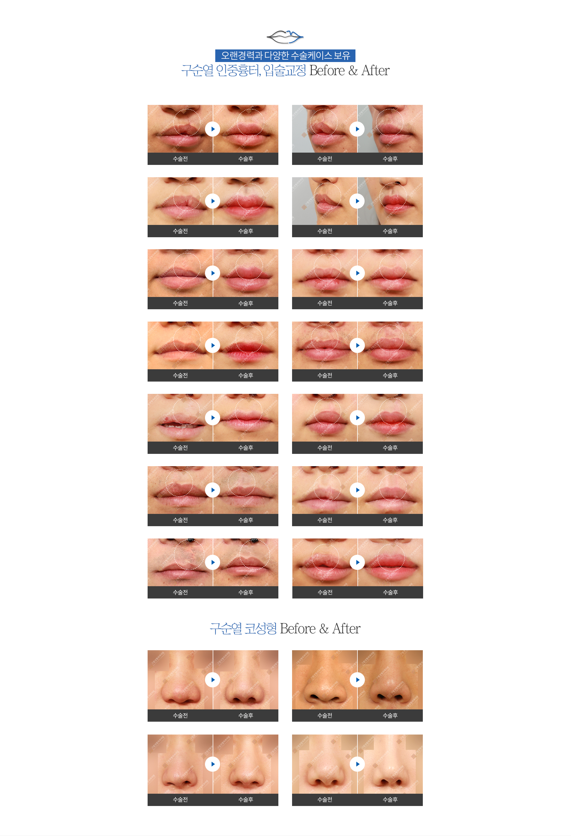 ׸ܰ 30 ̻ Ͽ 뼺,  -  , Լ Before & After /  ڼ Before & After